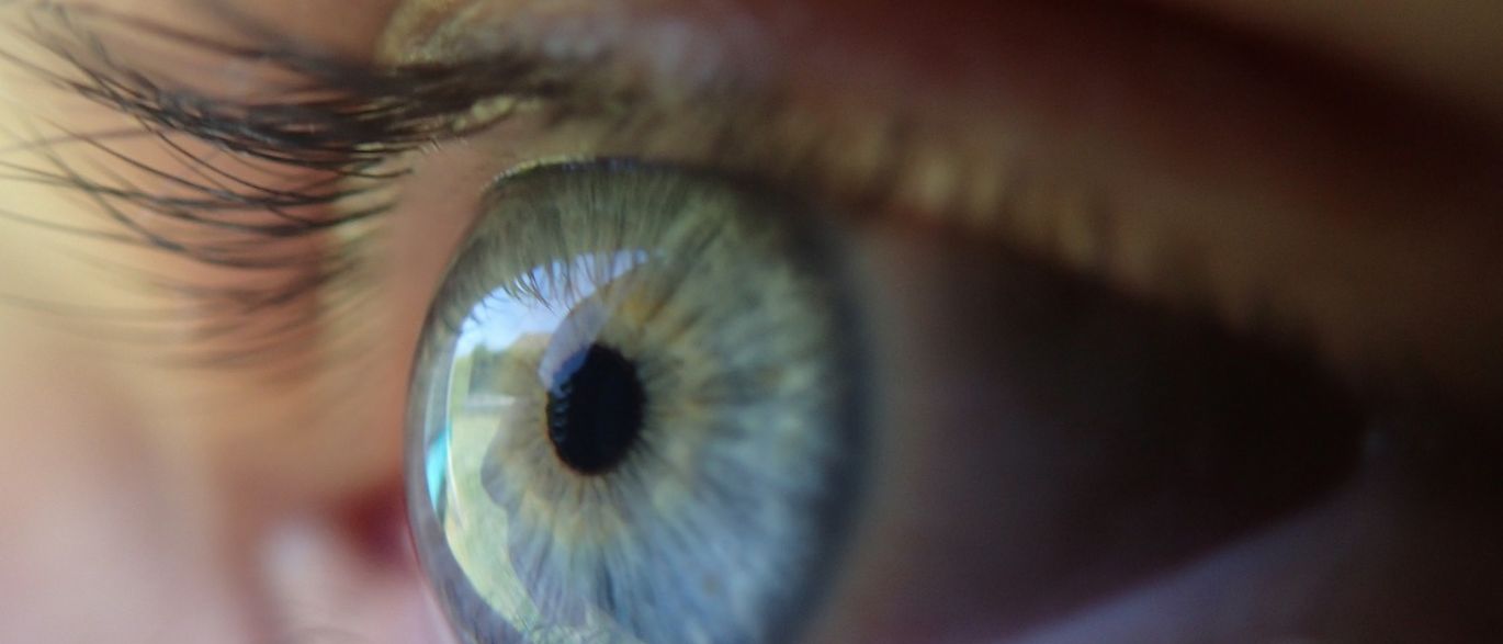 olhos-amarelados-saiba-o-que-pode-ser.jpg